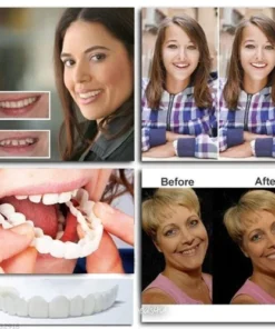 Fivfivgo™ Adjustable Snap-On Dentures