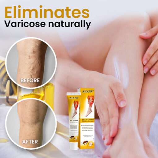 AEXZR™ Bee Venom Varicose Cure Cream