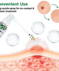 AEXZR™ Herbal Moles & Warts Removal Spray