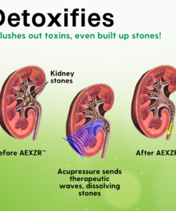 AEXZR™ Kidney Care Acupressure Pads