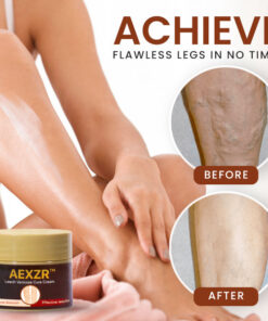 AEXZR™ Leech Varicose Cure Cream