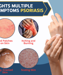 AEXZR™ Multi-Symptom Psoriasis Cream