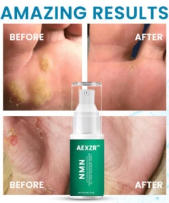 AEXZR™ NMN All-Skin Treatment Spray