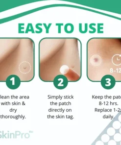 AEXZR™ Skin Tag Remover Patch