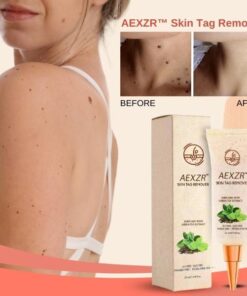 AEXZR™ Skin Tag Remover