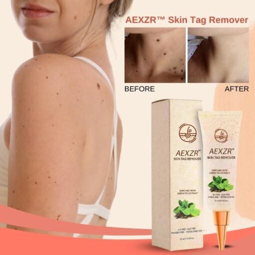 AEXZR™ Skin Tag Remover