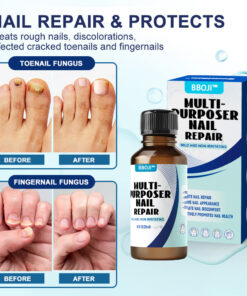 BBOJI™-Fungal Nail Repair Solution