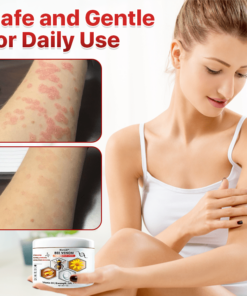 Biancat™ Bee Venom Psoriasis Relief Cream