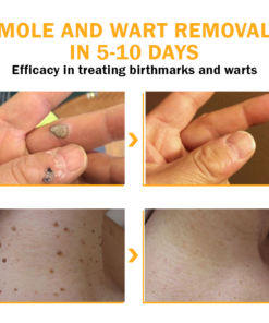 Biancat™ FlawlessFix Mole & Wart Removal Cream