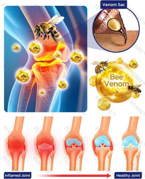 FLYCARE™ Bee Sting Joint and Bone Therapy Cream