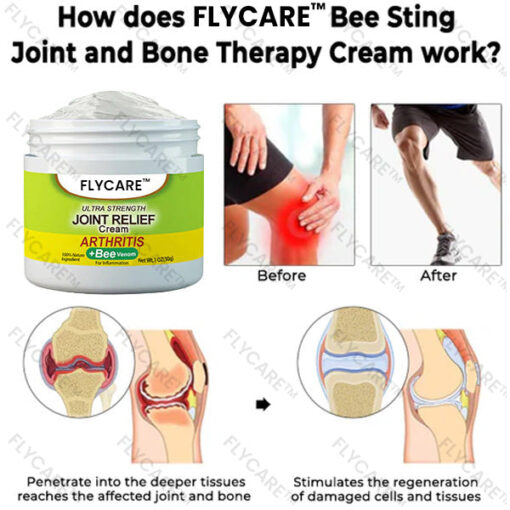 FLYCARE™ Bee Sting Joint and Bone Therapy Cream