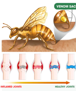 FLYCARE™ Bee Venom Advanced Joint and Bone Therapy Cream