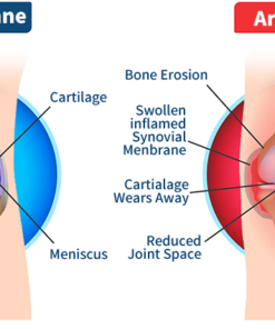 FLYCARE™ Bee Venom Advanced Joint and Bone Therapy Cream