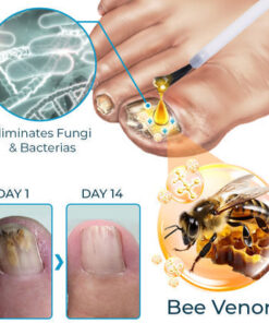 FLYCARE™ Bee Venom Nail Fungus Treatment Elixir