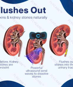 FLYCARE™ Kidney Care EMS Massage Pad