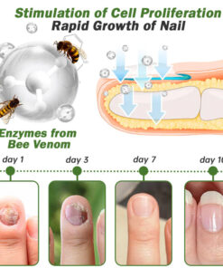 FLYCARE™ Nail Fungus Treatment Serum