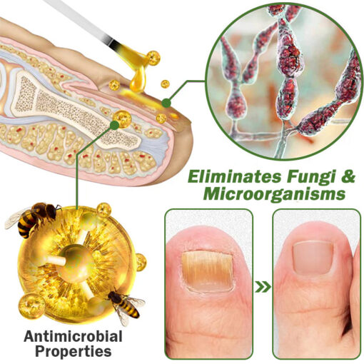 FLYCARE™ Nail Fungus Treatment Serum