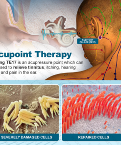 FLYCARE™ TinniCalm Tinnitus Treatment Ear Patch