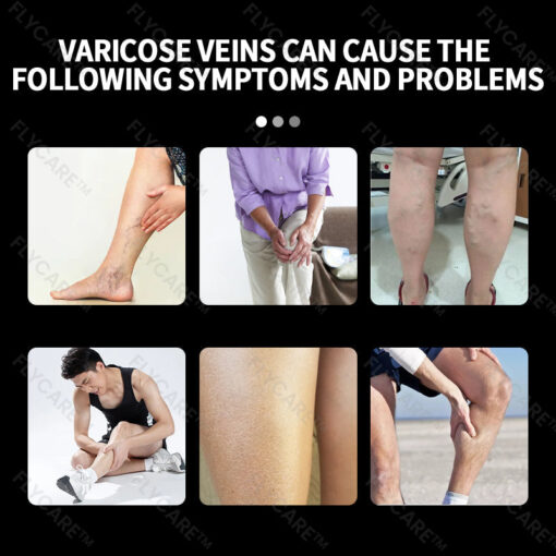 FLYCARE™ Varicose Veins Spray