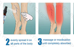 FLYCARE™ Varicose Veins Spray