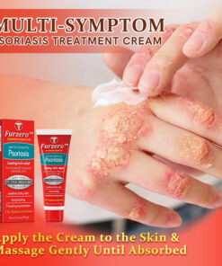 Furzero™ Psoriasis Anti-Itch Treatment Lotion