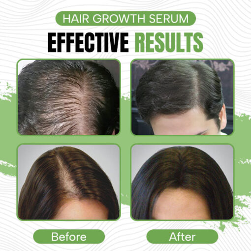 Hair Maximum Herbal Hair Growth Serum