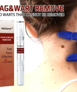 Histone™ Tags & Moles Remover