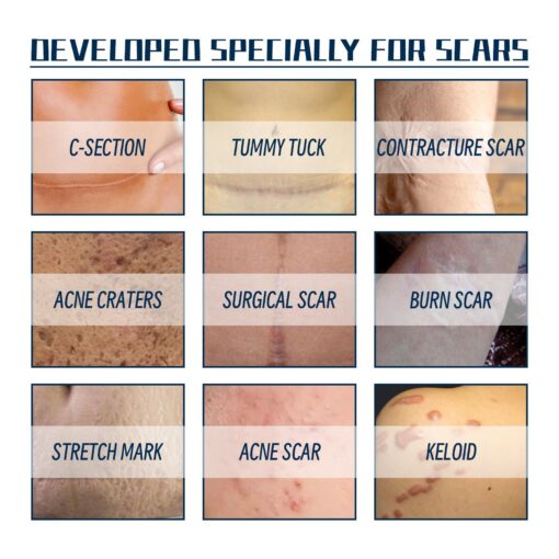 LOVILDS™ PREMIUM FORMULA Scar Gel