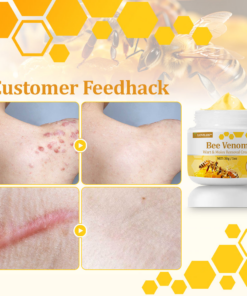 LOVILDS™ TagCure Bee Venom Wart & Moles Removal Cream