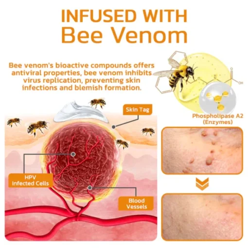 Luhaka™ Bee Venom Mole & Wart Removal Cream