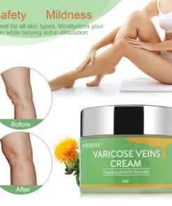 Negusy® Veins Cream: Complete Treatment for Varicose Veins