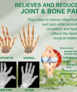 New Zealand Bee-Infused Joint and Bone Therapy Advanced Cream