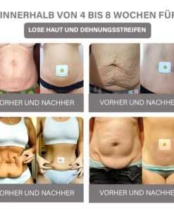 Oveallgo™ Schlangengift-Lymph-Detox-Pflaster