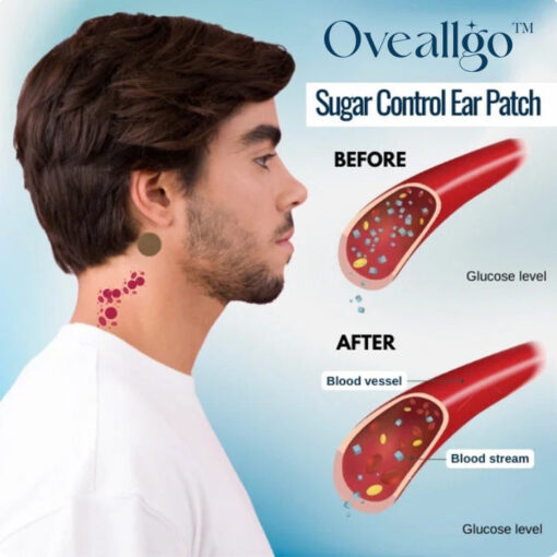 Oveallgo™ Sugar Control Ear Patch