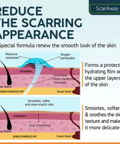 ScarRemove For All Types of Scars