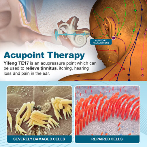 TinniLief™ Herbal Tinnitus Treatment Roller