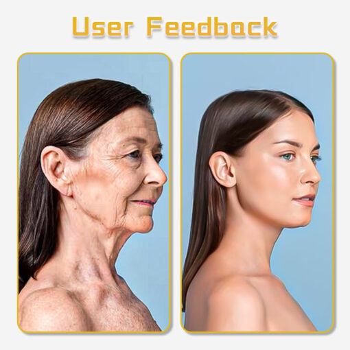 UltraRenew Ultrasonic Facelift Device