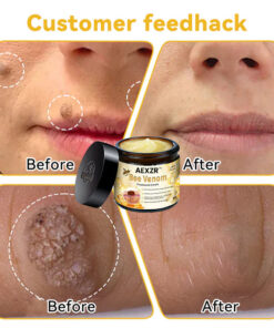 AEXZR™ Bee Venom Skin Treatment Cream