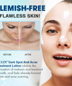 AEXZR™ Dark Spot And Acne Treatment Lotion