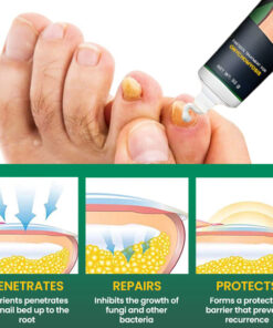 AEXZR™ Nail Care Anti Fungal Cream