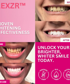 AEXZR™ Teeth Whitening Patches