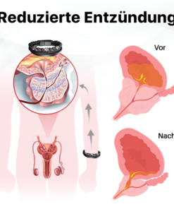 Biancat™ EnergiCore Prostata Gesundheitsarmband