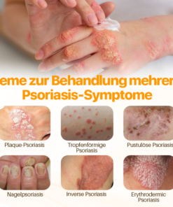 Biancat™ Psoriasis Anti-Bakteriellen Creme