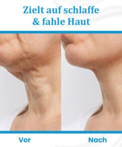 Ceoerty™ EternaLIFT Ultra Straffende Hautcreme