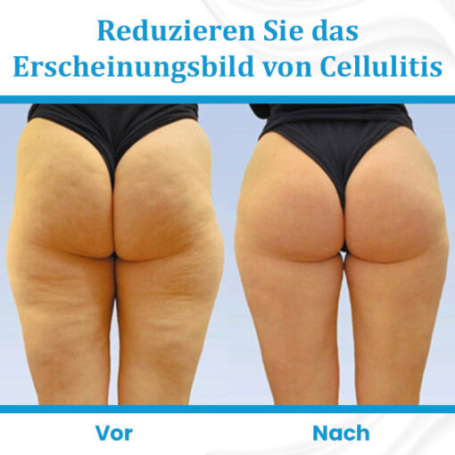 Ceoerty™ EternaLIFT Ultra Straffende Hautcreme