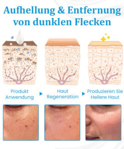 Ceoerty™ EternaLIFT Ultra Straffende Hautcreme