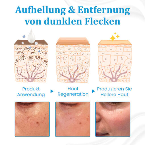 Ceoerty™ EternaLIFT Ultra Straffende Hautcreme