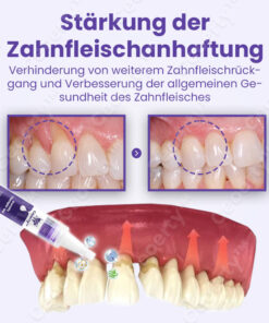 Ceoerty™ Gumtify Therapie-Gel