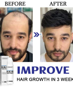 Dobshow™ Hair Rejuvenation Treatment