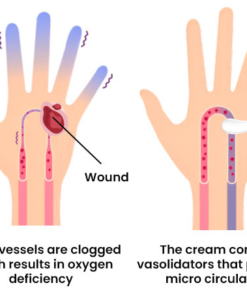 FLYCARE™ Diabetic Wounds Healing Ointment